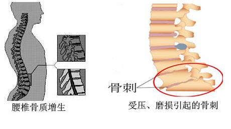 绿巨人视频app黄色官方下载仪的专业厂家阐述骨质增生与骨质疏松,仪器专业检测绿巨人视频app黄色官方下载正常值