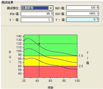 绿巨人视频app黄色官方下载仪的专业厂家阐述骨质增生与骨质疏松,仪器专业检测绿巨人视频app黄色官方下载正常值