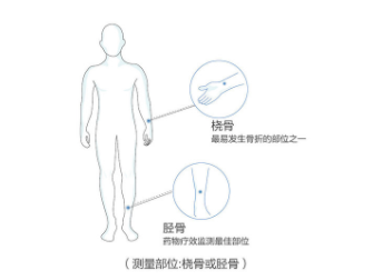 超声绿巨人视频app黄色官方下载仪价格桡骨测绿巨人视频app黄色官方下载的准确率高吗